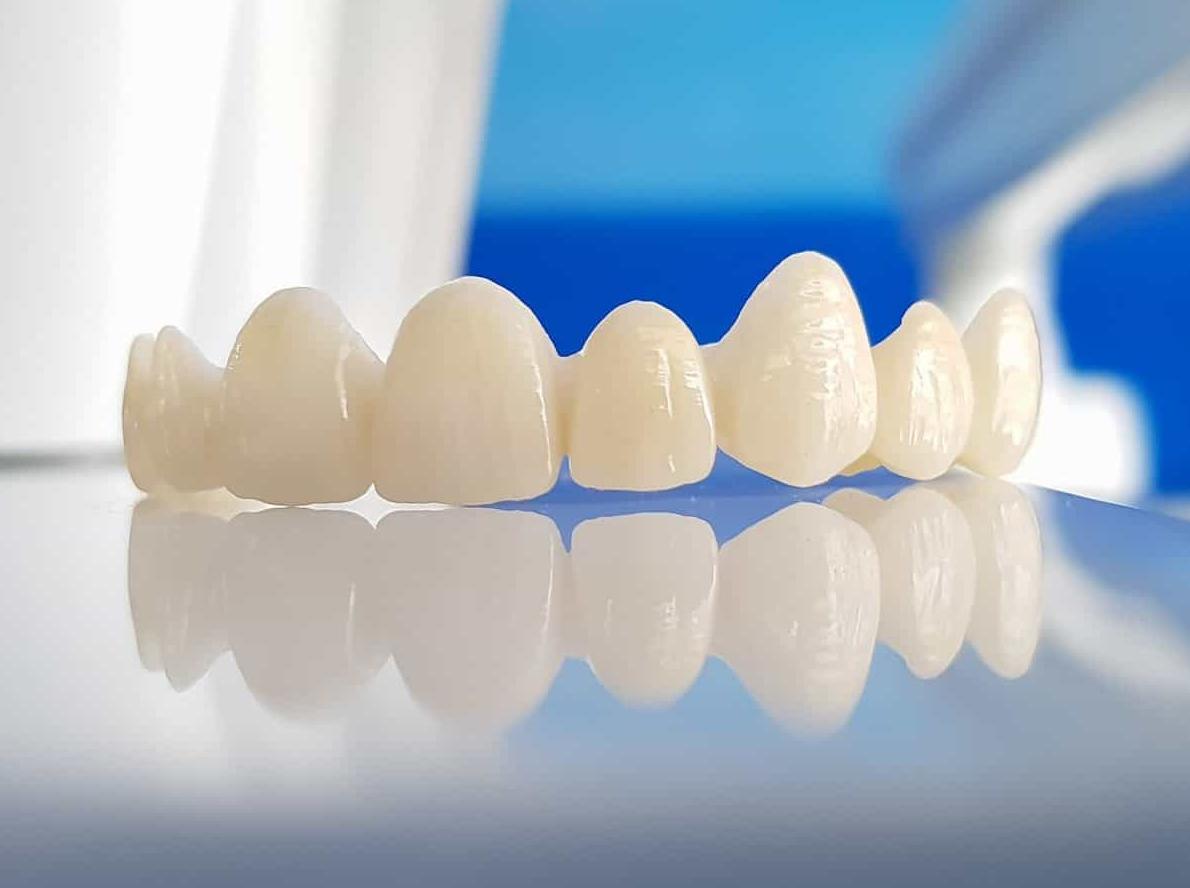 Răng Sứ Mỹ Là Gì? Giá Bao Nhiêu? Có Tốt Không? - Nha Khoa Đông A